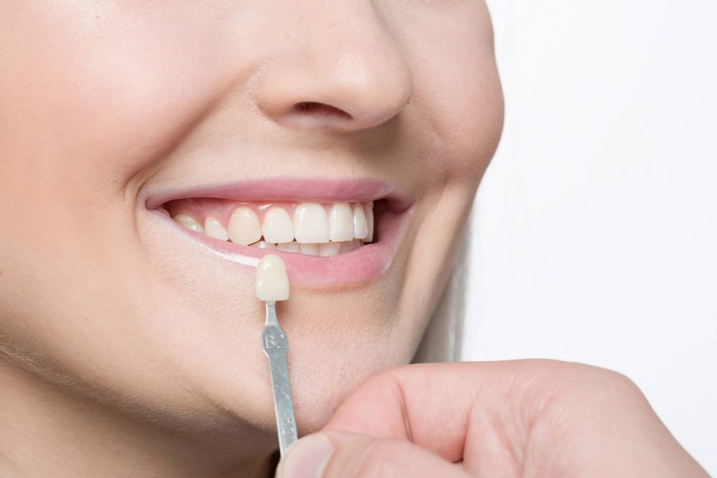 טיפול כתר לשיניים